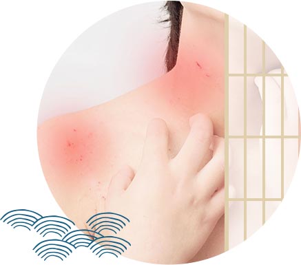 アトピー性皮膚炎、乾癬、脱毛症など