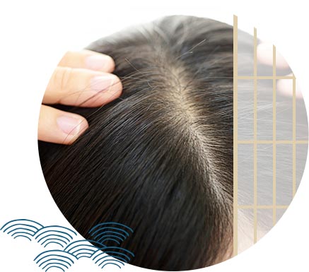 ニキビ、薄毛治療のメニュー